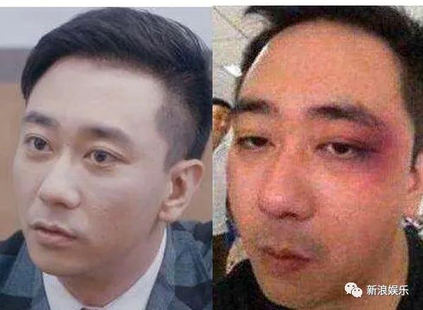 脱口秀演员王自健抑郁症_王自健 脱口秀 炒股_王自健家暴传闻